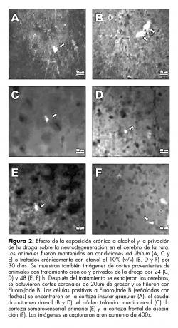 Efecto de la exposición crónica a alcohol y la privación de la droga sobre la neurodegeneración en el cerebro de la rata.